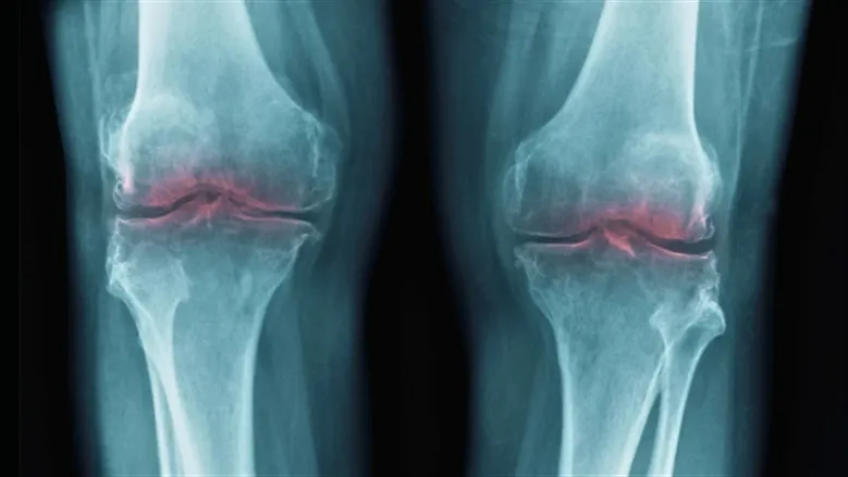 غضروف — SA news